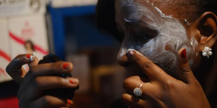 Bleaching Creams And Injections Become Scamming Items In Cameroon, Other West African Countries